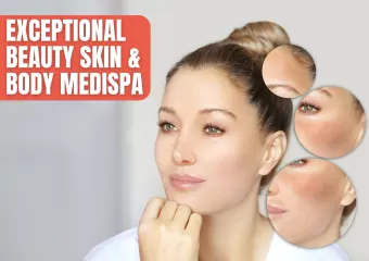 Exceptional Beauty Skin and Body Medispa