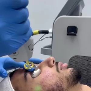 Alux Spa