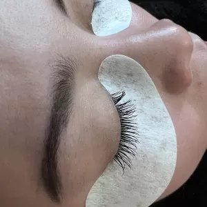 Dream Beauty esthetics and laser hair removal