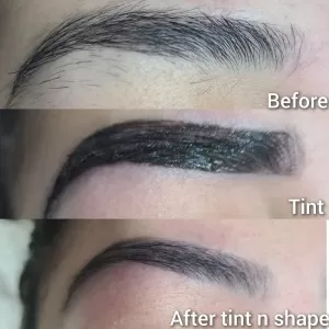 Sparsh Skin Studio